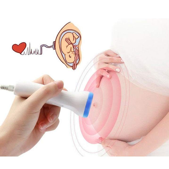Monitor Fetal Doppler Portabil | BabyEcho