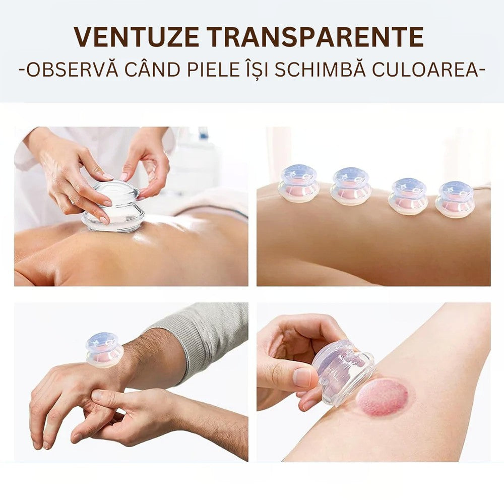 Set 4 Ventuze de Cupping, Vivimall, Pentru Masaj Anticeluluitic, din Silicon, Alb Transparent - vivimall.ro